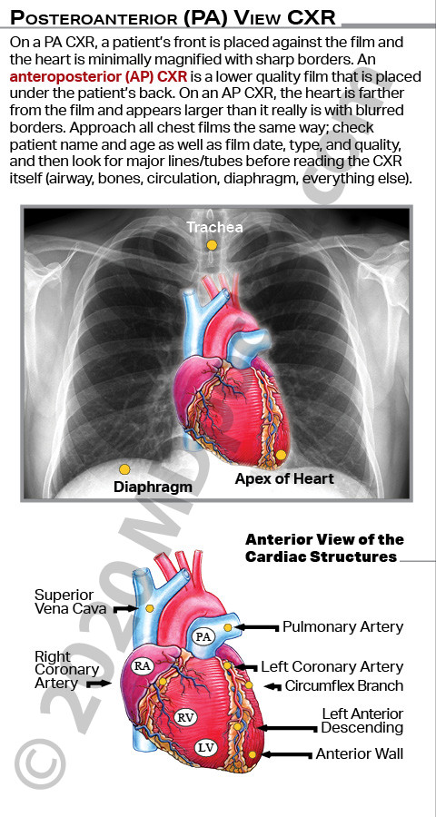 CXR-Lungs