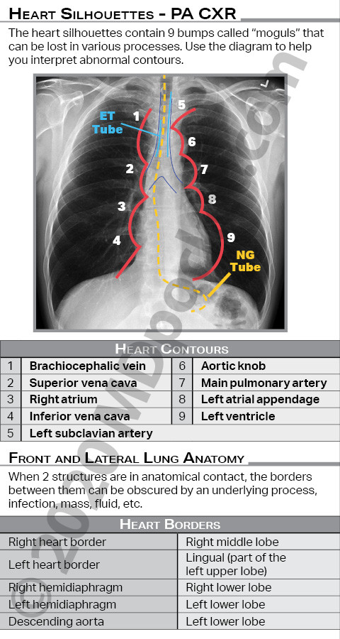 CXR-Lungs