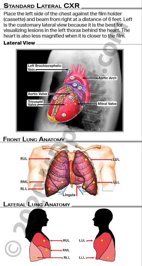 CXR-Lungs