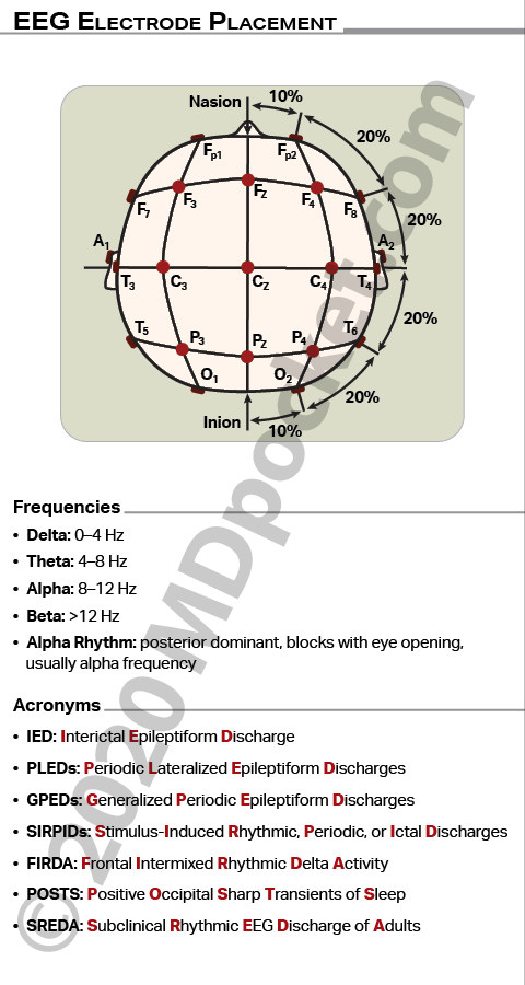 EEG_Placement