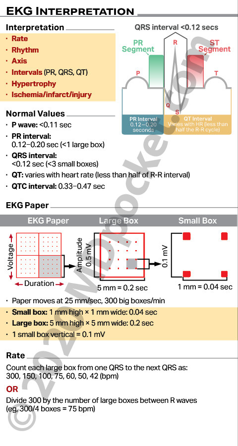 EKG