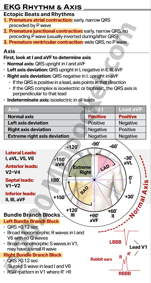 EKG