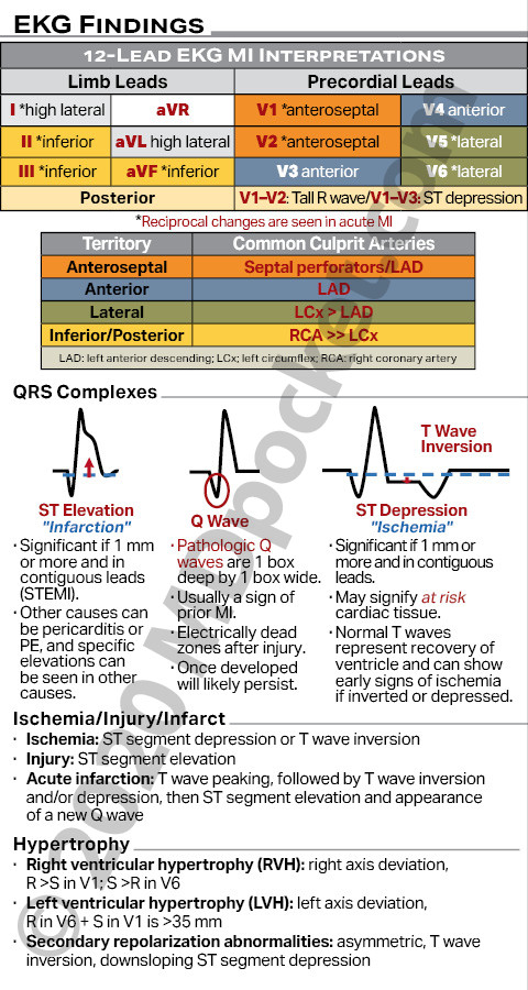 EKG