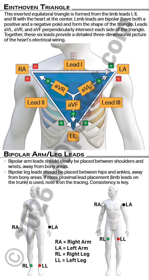 EKG_Leads