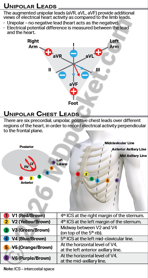 EKG_Leads