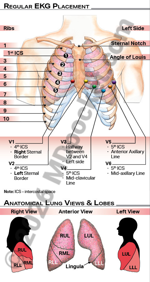 EKG_Leads