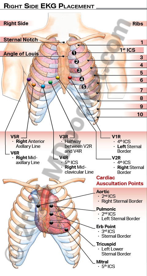 EKG_Leads