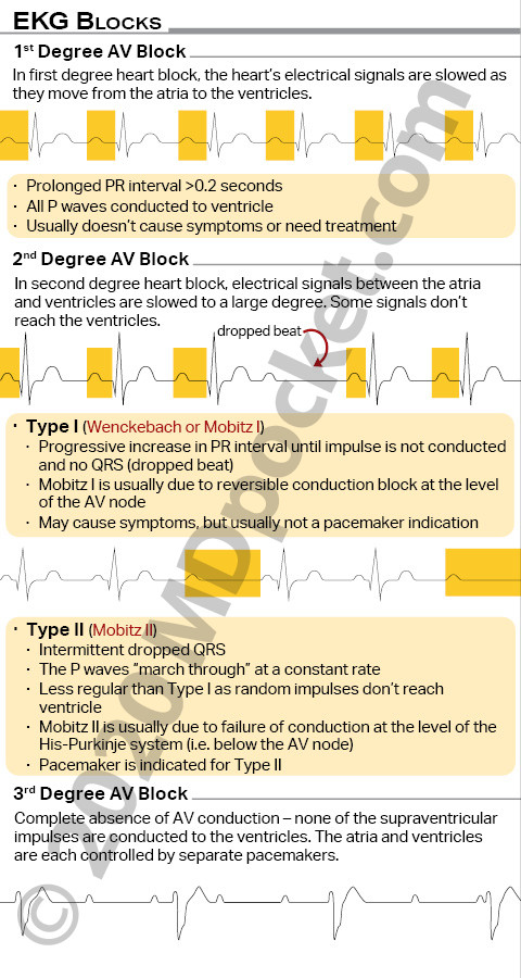 EKG_SNF