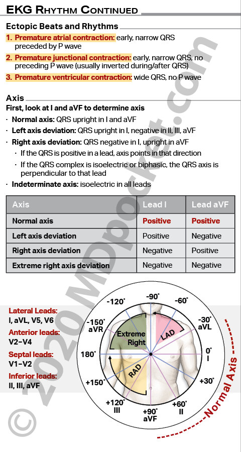 EKG_SNF