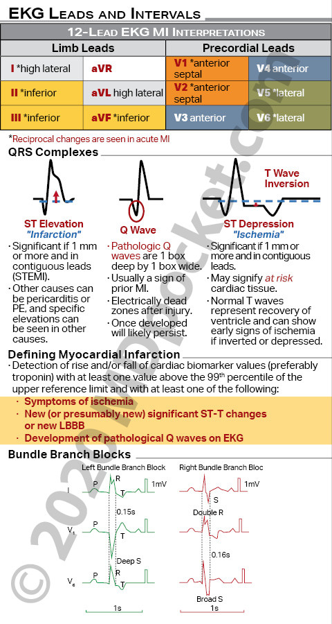 EKG_SNF