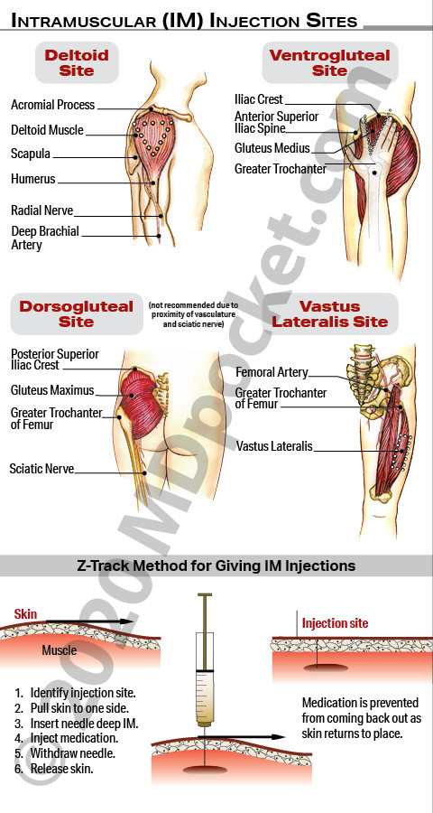 Injections