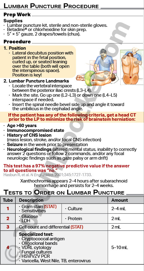 Lumbar_Puncture_Procedure