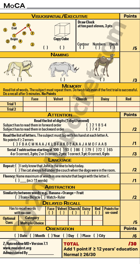 Monteal_Cognitive_Assessment