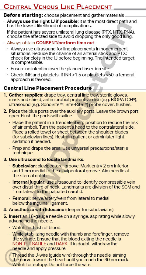 Procedures