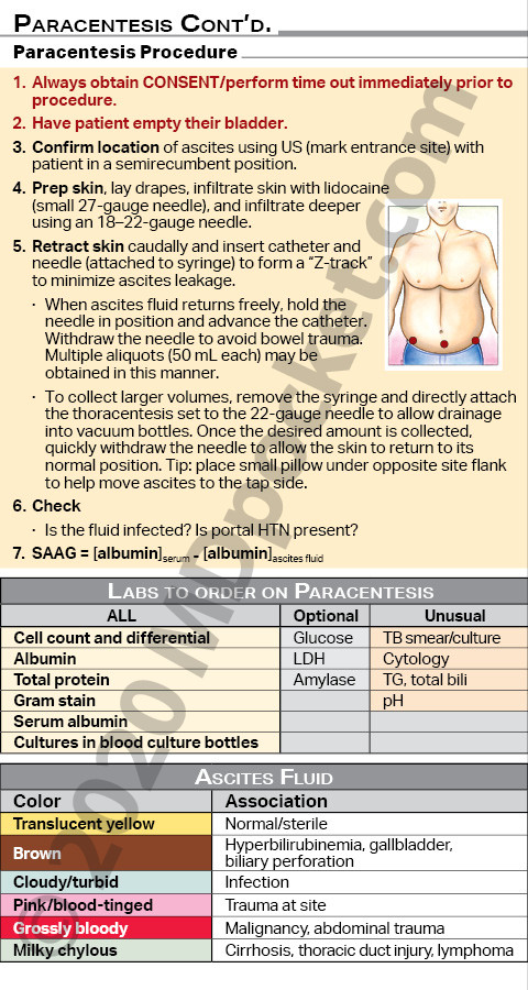Procedures