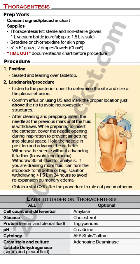 Procedures