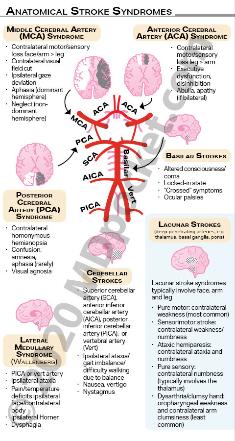 Stroke