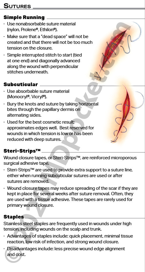 Sutures