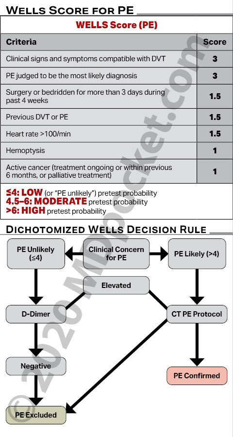 WSU_PulmCC_Wells_Score_for_PE_and_DVT
